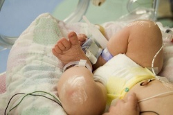 Dossier Vroeggeboorte: prematuur geboren baby